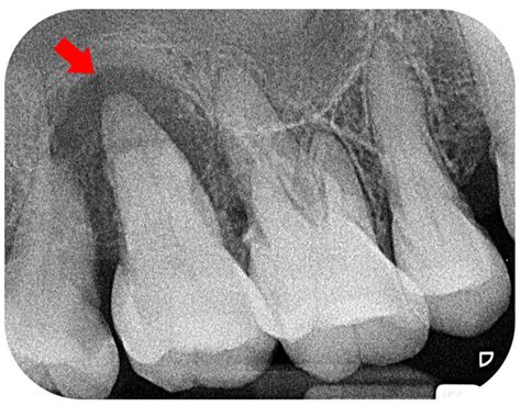 Why Do I Need X-Rays When I Visit the Dentist? - Twinkle Family Dentalcare