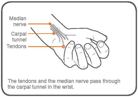 Carpal Tunnel Syndrome Stretches