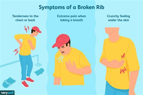 How To Help A Broken Rib - Classeconomy3