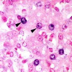 Canid herpesvirus-1 associated lesions in the kidney and liver. A) The... | Download Scientific ...