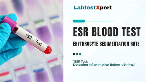 ESR Blood Test (Erythrocyte Sedimentation Rate): Your Body's Early Warning System - Labtestxpert.com