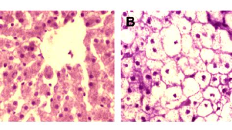 Feline hepatic lipidosis