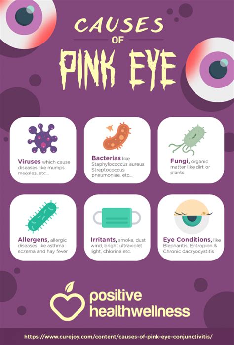 6 Causes Of Pink Eye (Conjunctivitis) - Infographic