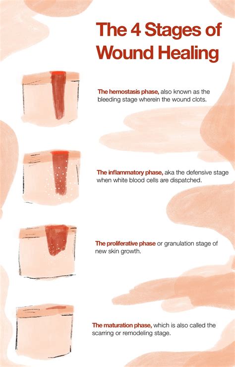 Healing Process