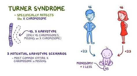 Turner Syndrome Diagram