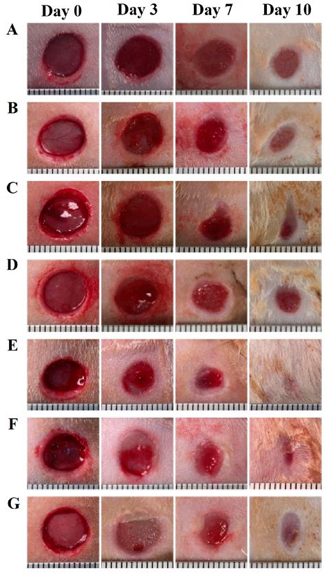 Bioengineering | Special Issue : Advances in Wound Healing Systems