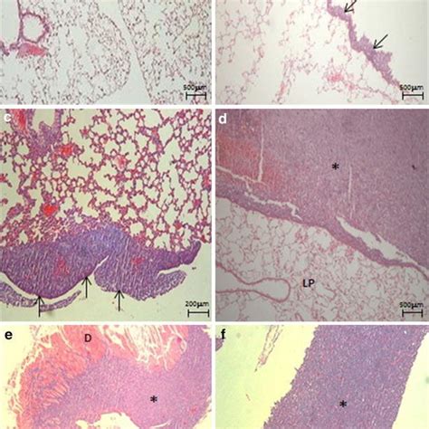 Histology of pleura, lung parenchyma and diaphragm of mice that ...