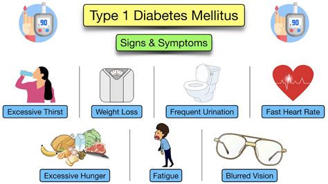 Type 1 Diabetes Mellitus Causes Symptoms And Complications – NBKomputer