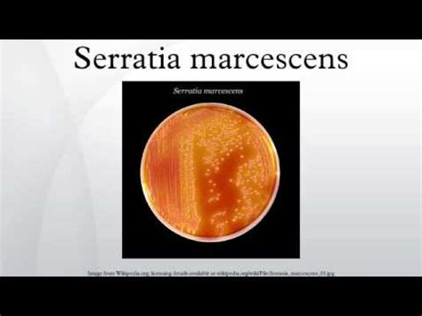 Serratia marcescens - Missy Allred