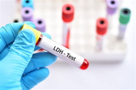 LDH Blood Test: What is it Used For? - Discounted Labs