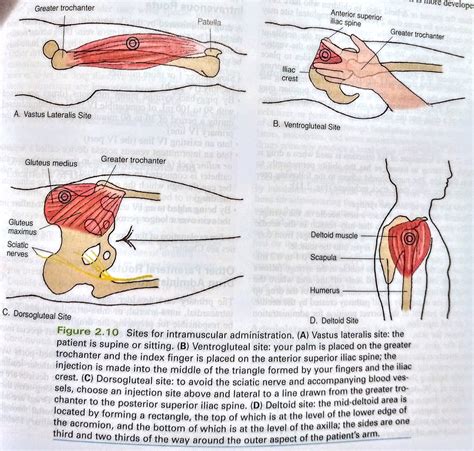 #Pharmacology #injection sites for intramuscular administration | Online nursing schools ...