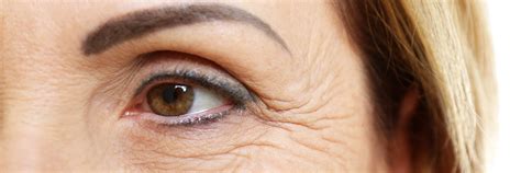 Wrinkle Reduction West Orange NJ | Fine Lines Livingston | Wrinkles