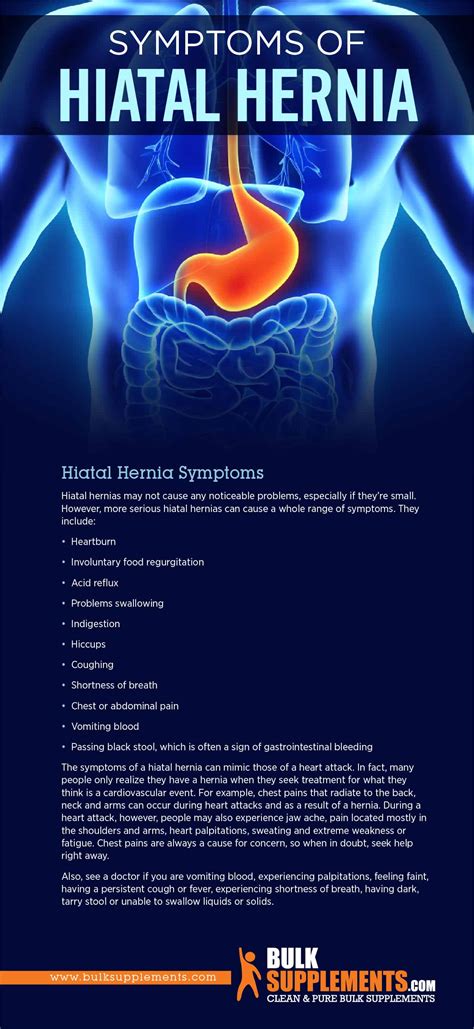 Tablo | Read 'Hiatal Hernia: Symptoms, Causes & Treatment' by