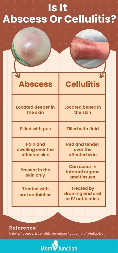 Cellulitis Abscess