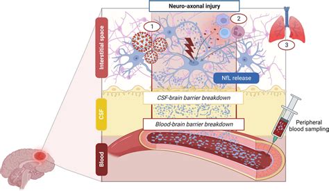 Mechanisms leading to blood neurofilament light chain (NfL) increase in... | Download Scientific ...