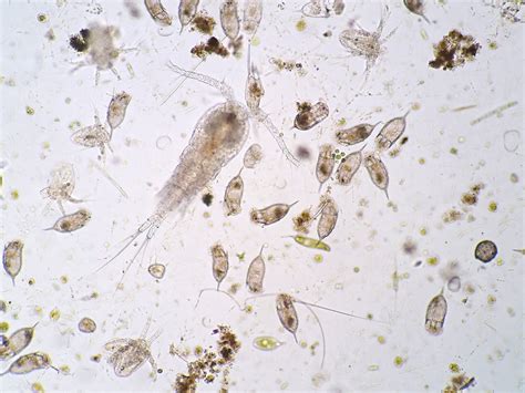 Freshwater Communities & Plankton - Biology Online Tutorial