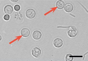 What Causes White Blood Cells In Dog Urine