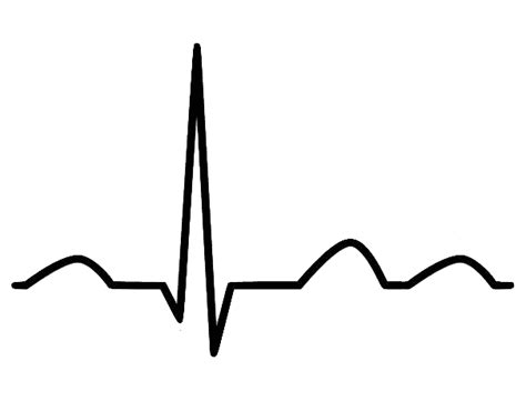 The Basic Guide to ACLS ECG Interpretation