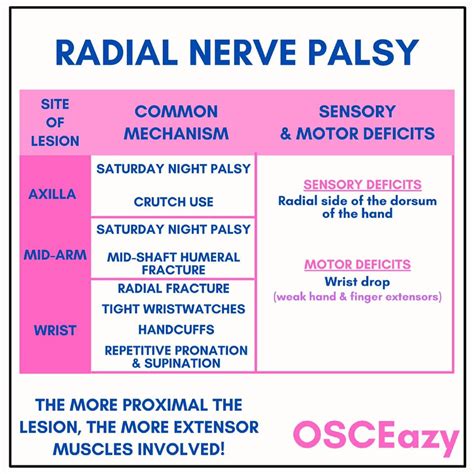 OSCEazy - Here’s a cheat sheet on radial nerve palsy! Make...