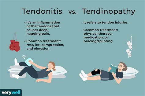 What Is The Difference Between Tendonitis Tendinosis And Tendinopathy ...