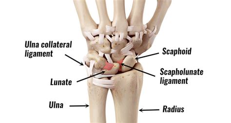 Ulnar Collateral Ligament Wrist Mri