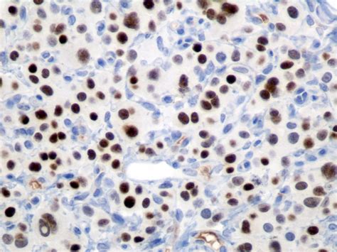 Immunohistochemical Staining Techniques | Histology