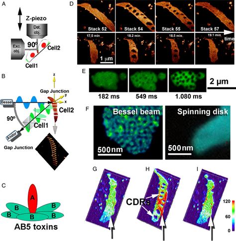 Super Resolution Bessel beam plane illumination microscopy reveals... | Download Scientific Diagram