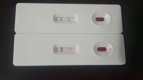 175 Causes Of False Negative Hiv Test False Positive