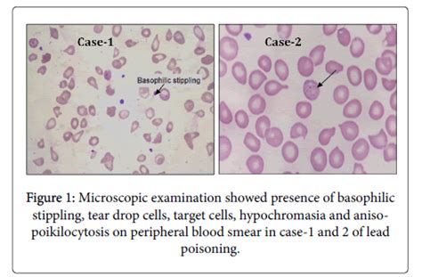 clinical-toxicology-Microscopic-examination