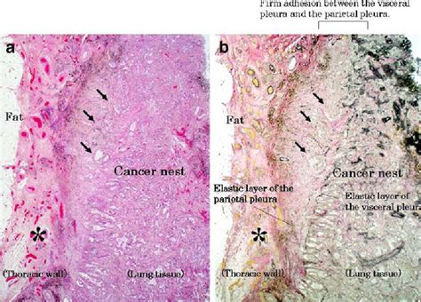 Histology Of Pleura