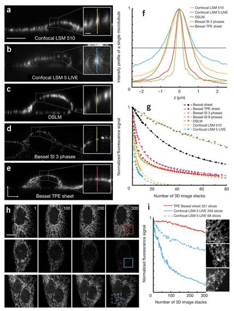 Comparisons of Bessel beam plane illumination to confocal microscopy... | Download Scientific ...