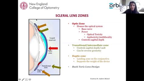 Contact Lens Fitting Guide