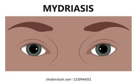 Miosis Eye Pupil Size Iris Retina Stock Vector (Royalty Free) 2130944351 | Shutterstock