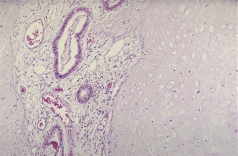 Pulmonary Pathology