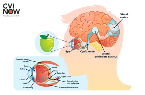 The visual pathway from the eye to the brain-Perkins School for the ...