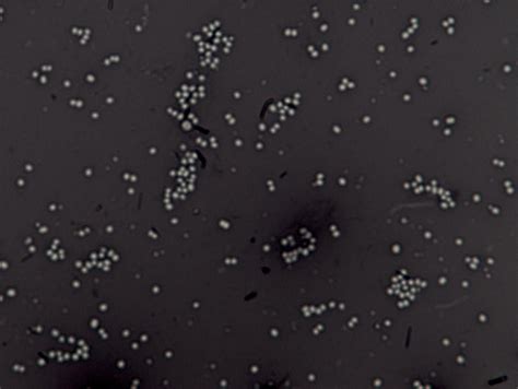 negative stain microbiology – examples of negative stains – Aep22