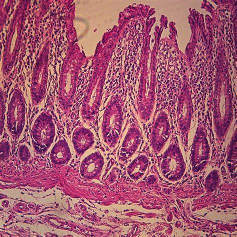 Human Glandular Epithelium, sec. 7 µm H&E Microscope Slide | Carolina.com