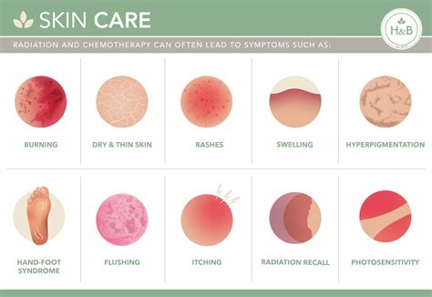 Skin Cancer Types Chart