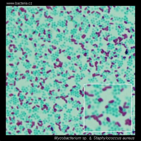 Acid-fast and non-acid-fast bacteria stained with Ziehl-Neelsen. Acid ...