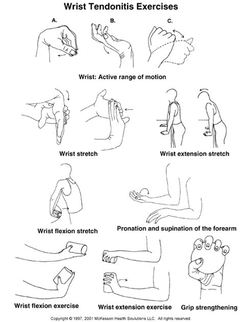 Sports Medicine Advisor 2003.1: Wrist Tendonitis Exercises: Illustration