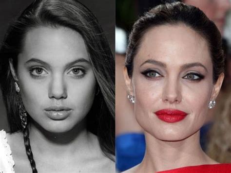 Angelina Jolie before and after plastic surgery 10 – Celebrity plastic surgery online