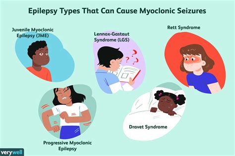 Different Types Of Seizures Chart - Best Picture Of Chart Anyimage.Org