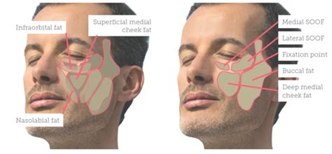 Buccal Fat Pad Anatomy