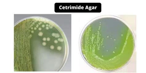 Cetrimide Agar - Composition, Principle, Preparation, Results, Uses - Biology Notes Online