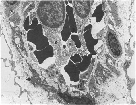 Electron micrograph taken: the basal lamina (bl). Some platelets (pl | Download Scientific Diagram