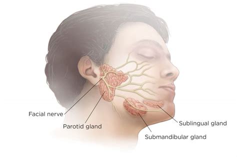 Parotid Gland Swelling