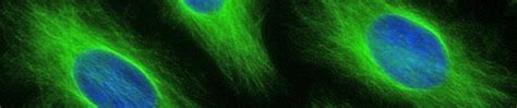 Alexa Fluor® 488 conjugated antibodies | Abcam