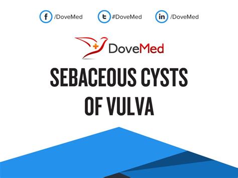 Sebaceous Cysts of Vulva (2022)