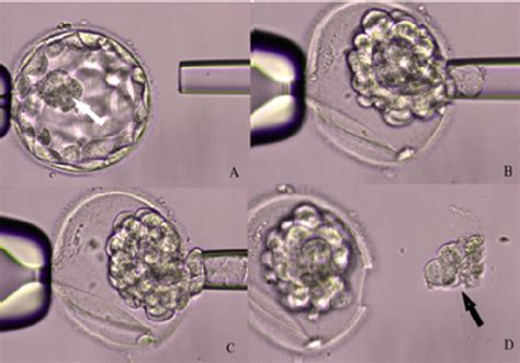 In the figure, the sequence of a blastocyst biopsy laser assisted is ...