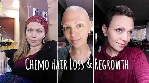 Chemotherapy Hair Loss Timeline